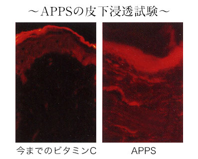 APPSの皮下浸透試験