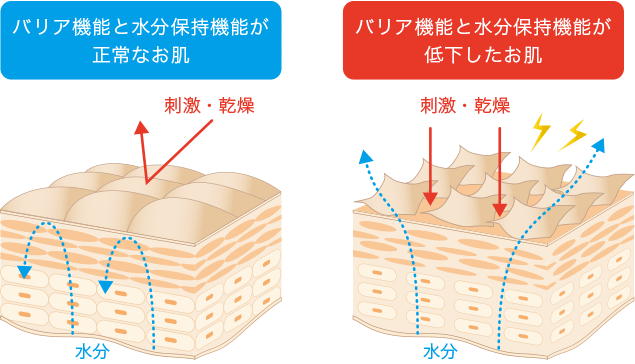 角層と表皮のバリア機能と水分保持機能が正常な場合と低下した場合の比較